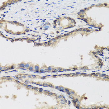 Immunohistochemistry of paraffin-embedded Rat brain using Phospho-Stat3(Y705) Polyclonal Antibody at dilution of  1:100 (40x lens).