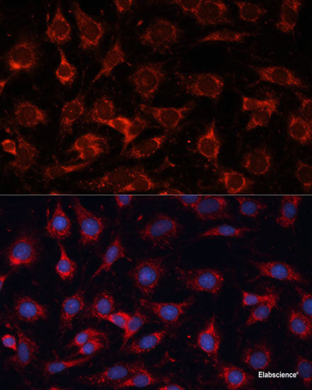 Immunofluorescence analysis of U2OS cells using Phospho-BRCA1(S988) Polyclonal Antibody at dilution of  1:100. Blue: DAPI for nuclear staining.