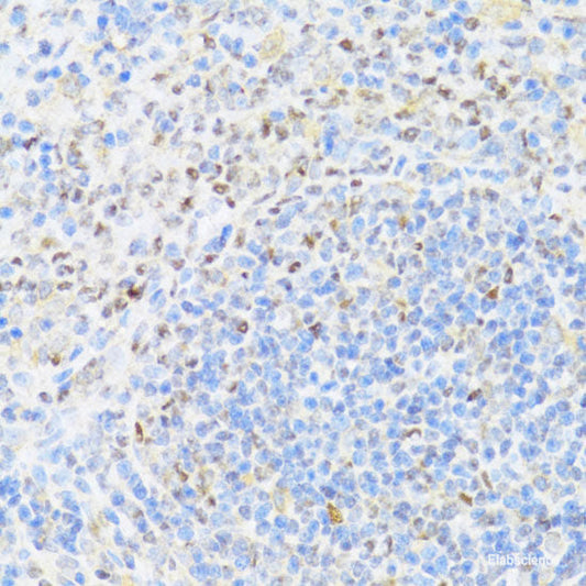 Western blot analysis of extracts from Mouse brain tissue using Phospho-SNCA(S129) Polyclonal Antibody.