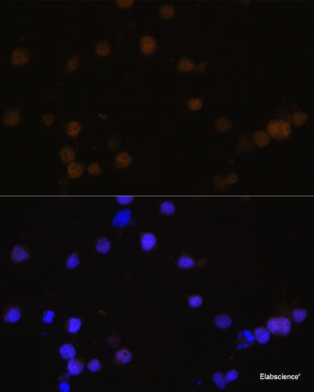 Immunohistochemistry of paraffin-embedded Mouse kidney using ENDOG Polyclonal Antibody at dilution of  1:100 (40x lens).