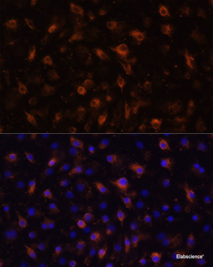 Immunohistochemistry of paraffin-embedded Rat liver using HDAC5 Polyclonal Antibody at dilution of  1:100 (40x lens).