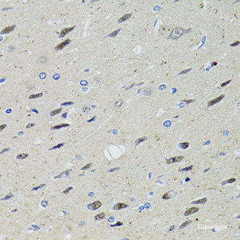 Immunohistochemistry of paraffin-embedded Human prostate using ATP1A Polyclonal Antibody at dilution of  1:100 (40x lens).