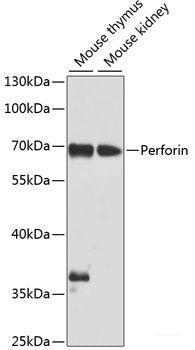 Immunohistochemistry of paraffin-embedded Rat brain using NRF2 Polyclonal Antibody at dilution of  1:100 (40x lens).