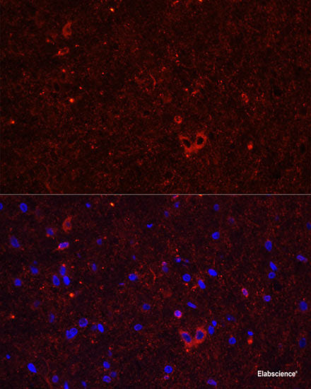 Immunohistochemistry of paraffin-embedded Rat brain using ACVR1C Polyclonal Antibody at dilution of  1:100 (40x lens).