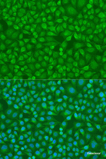 Immunohistochemistry of paraffin-embedded Rat heart using SOCS3 Polyclonal Antibody at dilution of  1:100 (40x lens).