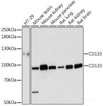 Immunohistochemistry of paraffin-embedded Rat kidney using PAK1 Polyclonal Antibody at dilution of  1:200 (40x lens).