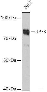 Immunofluorescence analysis of HeLa cells using KLF6 Polyclonal Antibody at dilution of  1:100. Blue: DAPI for nuclear staining.