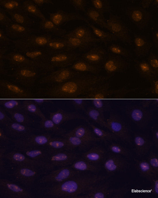 Immunohistochemistry of paraffin-embedded Human stomach using ATP4B Polyclonal Antibody at dilution of  1:100 (40x lens).