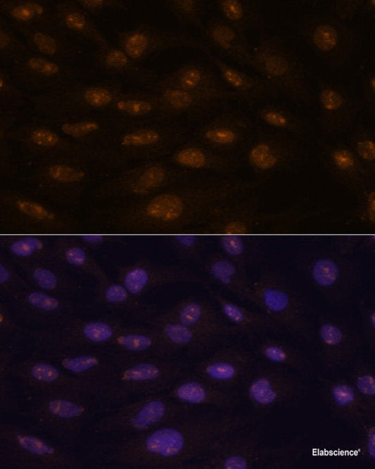 Immunohistochemistry of paraffin-embedded Human stomach using ATP4B Polyclonal Antibody at dilution of  1:100 (40x lens).