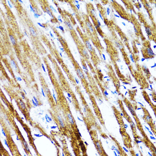Western blot analysis of extracts of Mouse kidney using ZCCHC4 Polyclonal Antibody at dilution of 1:1000.