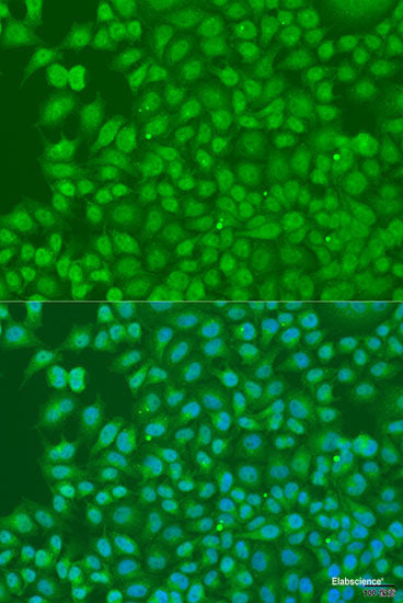 Immunohistochemistry of paraffin-embedded Rat liver using SEPT4 Polyclonal Antibody at dilution of  1:100 (40x lens).
