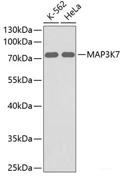 Immunohistochemistry of paraffin-embedded Rat ovary using KIF14 Polyclonal Antibody at dilution of  1:100 (40x lens).