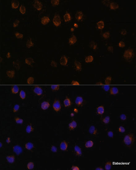 Immunohistochemistry of paraffin-embedded Rat brain using EGLN1/EGLN2 Polyclonal Antibody at dilution of  1:100 (40x lens).