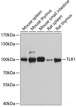 Immunohistochemistry of paraffin-embedded Human breast cancer using STOML2 Polyclonal Antibody at dilution of  1:100 (40x lens).