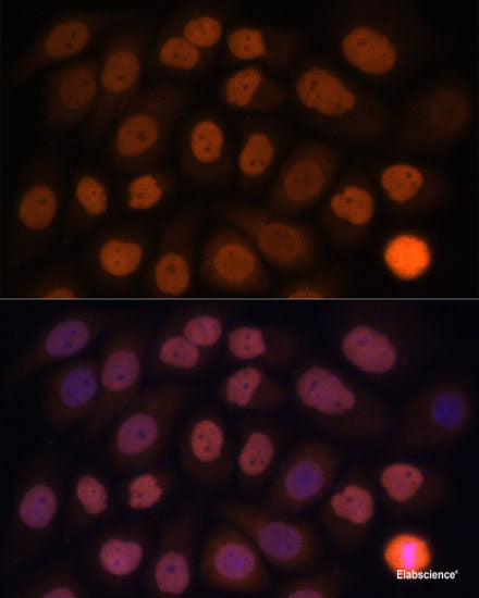 Immunohistochemistry of paraffin-embedded Rat liver using SLC4A5 Polyclonal Antibody at dilution of  1:100 (40x lens).