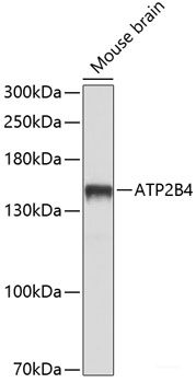 Immunofluorescence analysis of HeLa cells using VDAC3 Polyclonal Antibody at dilution of  1:100 (40x lens). Blue: DAPI for nuclear staining.