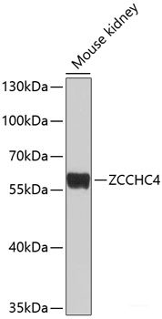 Immunofluorescence analysis of C6 cells using LGMN Polyclonal Antibody at dilution of  1:100 (40x lens). Blue: DAPI for nuclear staining.