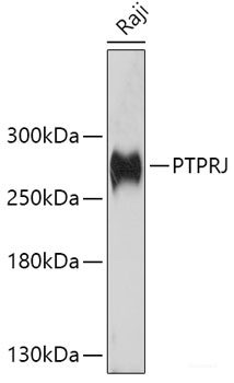 Immunofluorescence analysis of H9C2 cells using SRPRB Polyclonal Antibody at dilution of  1:100. Blue: DAPI for nuclear staining.