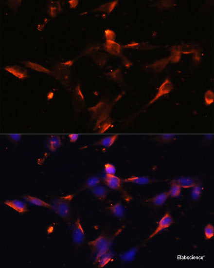 Immunohistochemistry of paraffin-embedded Human prostate using RNASE13 Polyclonal Antibody at dilution of  1:100 (40x lens).
