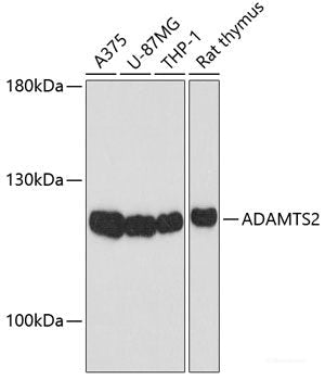 Western blot analysis of extracts of various cell lines using PPP1CB Polyclonal Antibody at dilution of 1:1000.
