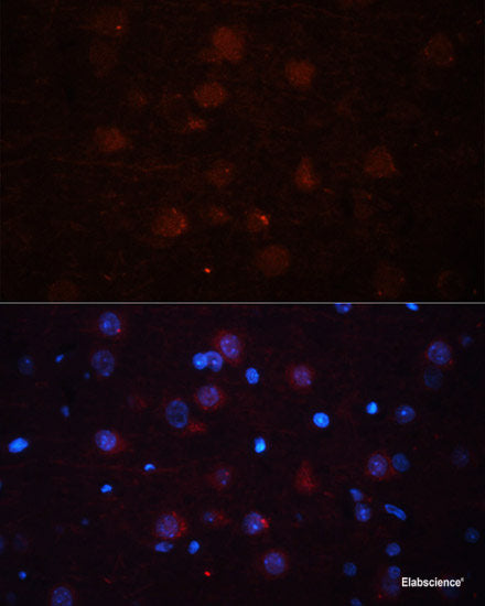 Immunohistochemistry of paraffin-embedded Mouse spleen using APP Polyclonal Antibody at dilution of  1:100 (40x lens).