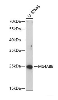 Immunohistochemistry of paraffin-embedded Mouse kidney using Tau Polyclonal Antibody at dilution of  1:100 (40x lens).