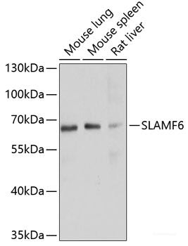 Immunofluorescence analysis of HeLa cells using Caspase-3 Polyclonal Antibody at dilution of  1:100 (40x lens). Blue: DAPI for nuclear staining.