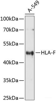 Immunohistochemistry of paraffin-embedded Rat brain using IL6 Polyclonal Antibody at dilution of  1:100 (40x lens).