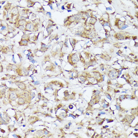 Immunohistochemistry of paraffin-embedded Human tonsil using IL6 Polyclonal Antibody at dilution of  1:100 (40x lens).