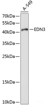 Immunohistochemistry of paraffin-embedded Mouse kidney using IKB alpha Polyclonal Antibody at dilution of  1:100 (40x lens).