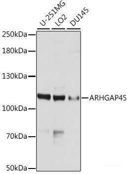 Western blot analysis of extracts of various cell lines using IKB alpha Polyclonal Antibody at dilution of 1:1000.