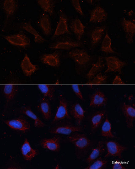 Immunohistochemistry of paraffin-embedded Human colon using FAK Polyclonal Antibody at dilution of  1:100 (40x lens).