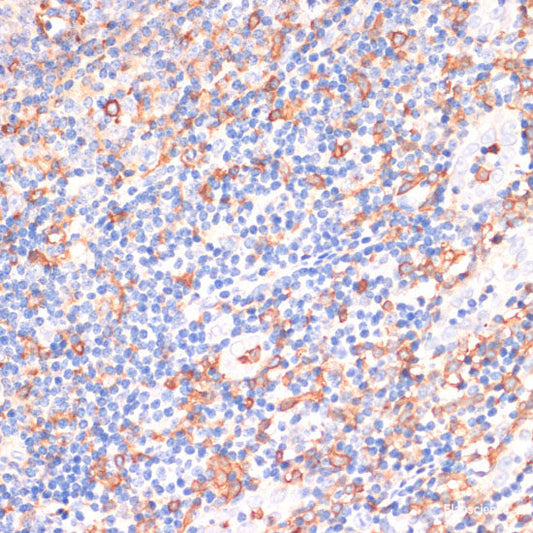 Immunohistochemistry of paraffin-embedded Human tonsil using EGFR Polyclonal Antibody at dilution of  1:150 (40x lens).