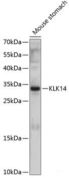 Immunohistochemistry of paraffin-embedded Human stomach using Lyn Polyclonal Antibody at dilution of  1:100 (40x lens).