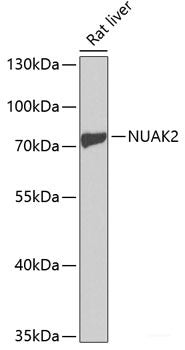 Immunofluorescence analysis of Y79 cells using Rb Polyclonal Antibody at dilution of  1:100 (40x lens). Blue: DAPI for nuclear staining.