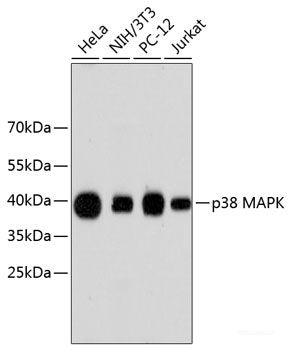 Immunohistochemistry of paraffin-embedded Rat ovary using MAP1LC3A Polyclonal Antibody at dilution of  1:100 (40x lens).