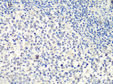 Immunofluorescence analysis of C6 cells using SOX2 Polyclonal Antibody at dilution of  1:100 (40x lens). Blue: DAPI for nuclear staining.