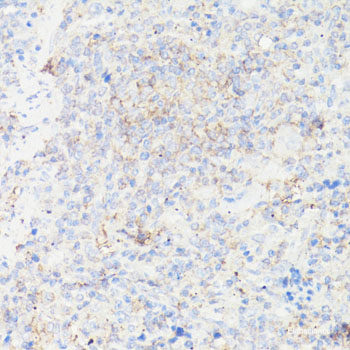 Immunofluorescence analysis of NIH/3T3 cells using DNAJA1 Polyclonal Antibody at dilution of  1:100. Blue: DAPI for nuclear staining.