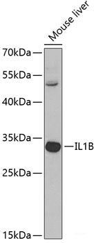 Immunofluorescence analysis of C6 cells using LAMTOR1 Polyclonal Antibody at dilution of  1:100 (40x lens). Blue: DAPI for nuclear staining.