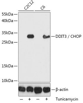 Immunohistochemistry of paraffin-embedded Human liver cancer using TGFBR2 Polyclonal Antibody at dilution of  1:100 (40x lens).
