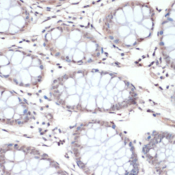 Immunohistochemistry of paraffin-embedded Human kidney using GGA2 Polyclonal Antibody at dilution of  1:200 (40x lens).