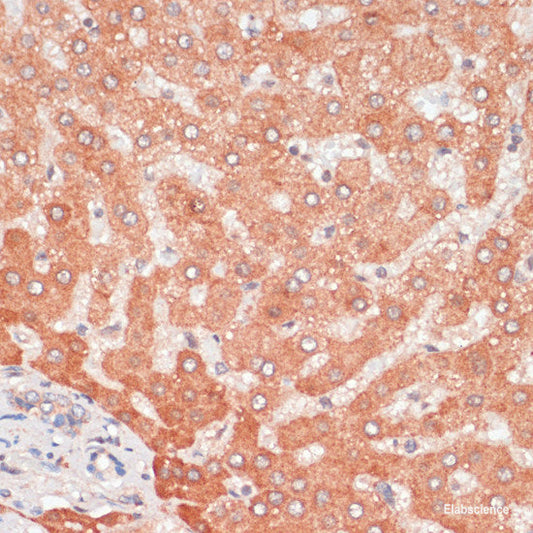 Immunohistochemistry of paraffin-embedded Rat intestine using HGF Polyclonal Antibody at dilution of  1:100 (40x lens).