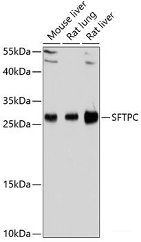 Western blot analysis of extracts of various cell lines using AGMAT Polyclonal Antibody at dilution of 1:1000.