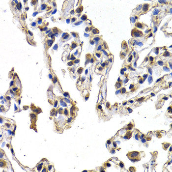 Immunofluorescence analysis of HeLa cells using BST2 Polyclonal Antibody at dilution of  1:100. Blue: DAPI for nuclear staining.