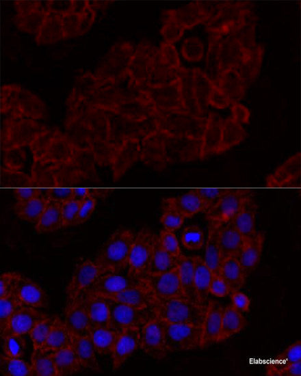 Immunohistochemistry of paraffin-embedded Rat brain using NTS Polyclonal Antibody at dilution of  1:100 (40x lens).
