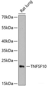 Immunohistochemistry of paraffin-embedded Rat heart using MYBPC3 Polyclonal Antibody at dilution of  1:100 (40x lens).