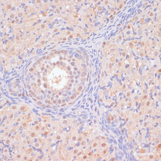 Immunohistochemistry of paraffin-embedded Human placenta using GPR78 Polyclonal Antibody at dilution of  1:100 (40x lens).