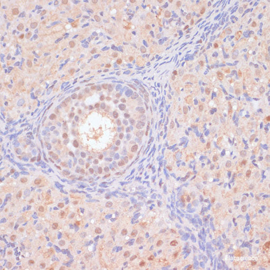 Immunohistochemistry of paraffin-embedded Human placenta using GPR78 Polyclonal Antibody at dilution of  1:100 (40x lens).