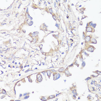 Immunofluorescence analysis of NIH/3T3 cells using GPC3 Polyclonal Antibody at dilution of  1:100. Blue: DAPI for nuclear staining.