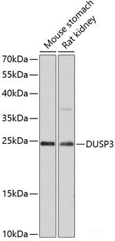 Western blot analysis of extracts of various cell lines using CD59 Polyclonal Antibody at dilution of 1:1000.